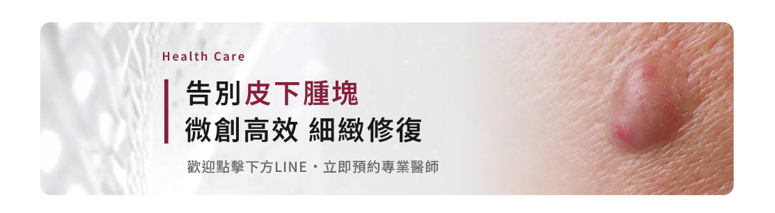 粉瘤微創手術怎麼做?脂肪瘤、肉芽、雞眼怎麼分?專業醫師教你皮膚腫塊居家自檢